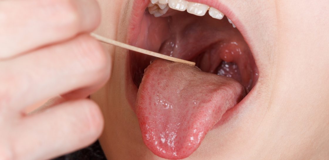 What do your tonsils do?