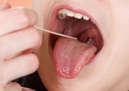 What do your tonsils do?